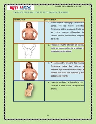 CANCER Y AUTOEXAMEN DE MAMA 
12 
2.6 PASOS PARA REALIZAR EL AUTO EXAMEN DE MAMAS 
ILUSTRACION 
DESCRIPCION 1. Párate delante del espejo y mírate los senos, con las manos apoyadas firmemente sobre su cadera. Fíjate se ve bultos, nuevas diferencias de tamaño y forma, inflamación o pliegues de la piel. 
2. Prestando mucha atención al espejo, junte las manos detrás de la cabeza y empújelas hacia delante. 
3. A continuación, presione las manos firmemente sobre las caderas e inclínese ligeramente hacia el espejo a medida que saca los hombros y los codos hacia delante. 
4. Levante un brazo y después el otro, para ver si tiene bultos debajo de los brazos. 
 