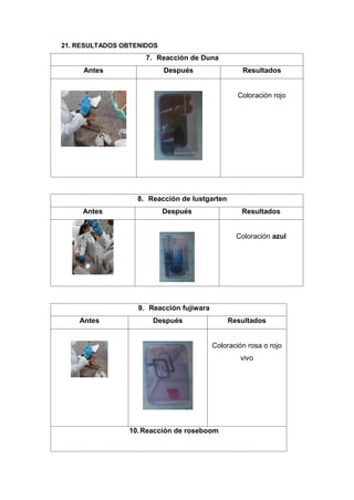 21. RESULTADOS OBTENIDOS
7. Reacción de Duna
Antes Después Resultados
Coloración rojo
8. Reacción de lustgarten
Antes Después Resultados
Coloración azul
9. Reacción fujiwara
Antes Después Resultados
Coloración rosa o rojo
vivo
10.Reacción de roseboom
 