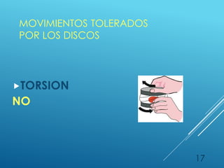 MOVIMIENTOS TOLERADOS
POR LOS DISCOS
TORSION
NO
17
 