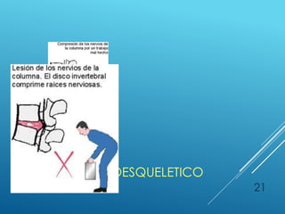 SISTEMA
ARTROMUSCULOESQUELETICO
21
 