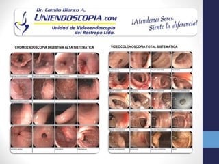 CROMOENDOSCOPIA DIGESTIVA ALTA SISTEMATICA   VIDEOCOLONOSCOPIA TOTAL SISTEMATICA
 