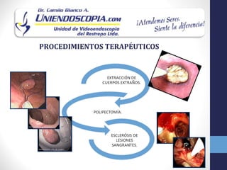 PROCEDIMIENTOS TERAPÉUTICOS
 