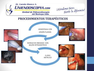 PROCEDIMIENTOS TERAPÉUTICOS
 