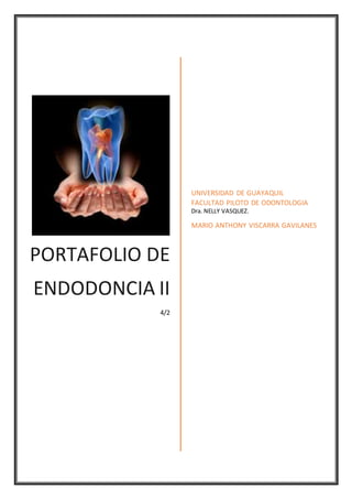 PORTAFOLIO DE
ENDODONCIA II
4/2
UNIVERSIDAD DE GUAYAQUIL
FACULTAD PILOTO DE ODONTOLOGIA
Dra. NELLY VASQUEZ.
MARIO ANTHONY VISCARRA GAVILANES
 