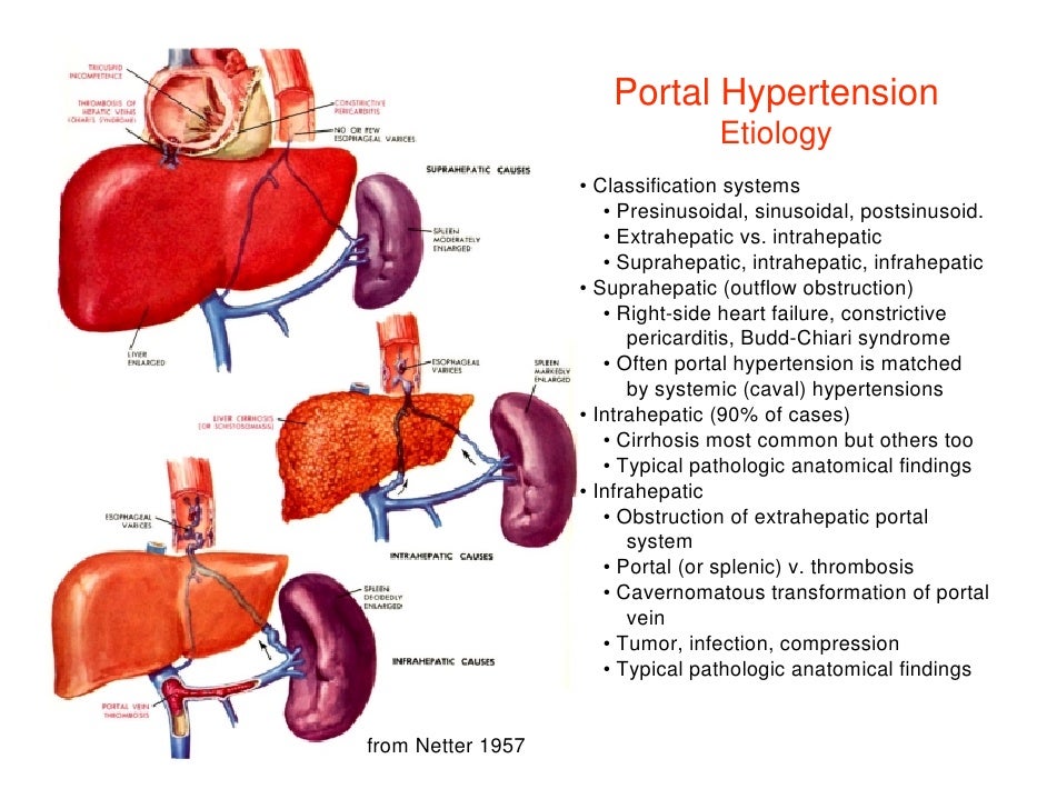 portal-hypertension-the-dada2-foundation