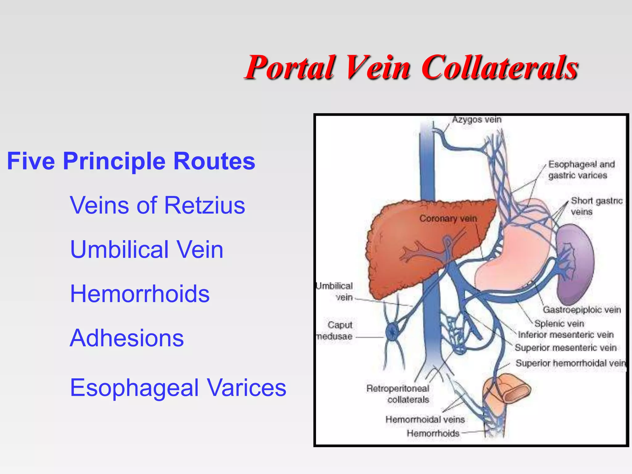 Portal Vein Collaterals
Five Principle Routes
Veins of Retzius
Umbilical Vein
Hemorrhoids
Adhesions
Esophageal Varices
 
