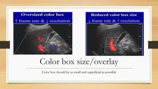 Color box size/overlay
Color box should be as small and superficial as possible
 