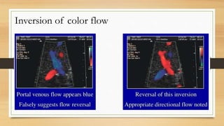 Inversion of color flow
 