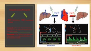 Antegrade- flow in the forward direction
with respect to its expected direction in the
circulatory system
Retrograde - flow in the reverse direction
with respect to its expected direction in
the circulatory system
Antegrade versus Retrograde
WRT circulatory
system
WRT transducer
 