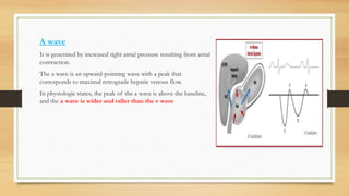 A wave
It is generated by increased right atrial pressure resulting from atrial
contraction.
The a wave is an upward-pointing wave with a peak that
corresponds to maximal retrograde hepatic venous flow.
In physiologic states, the peak of the a wave is above the baseline,
and the a wave is wider and taller than the v wave
 