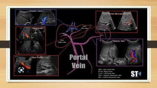 portal doppler ppt .pptx
