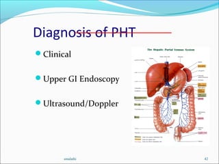 Diagnosis of PHT
Clinical
Upper GI Endoscopy
Ultrasound/Doppler
smalathi 42
 