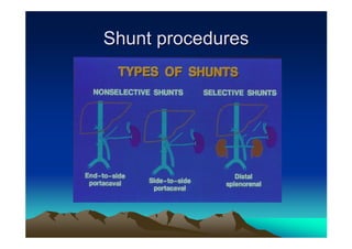 Shunt procedures
 