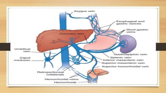 Portal hypertension surgical management