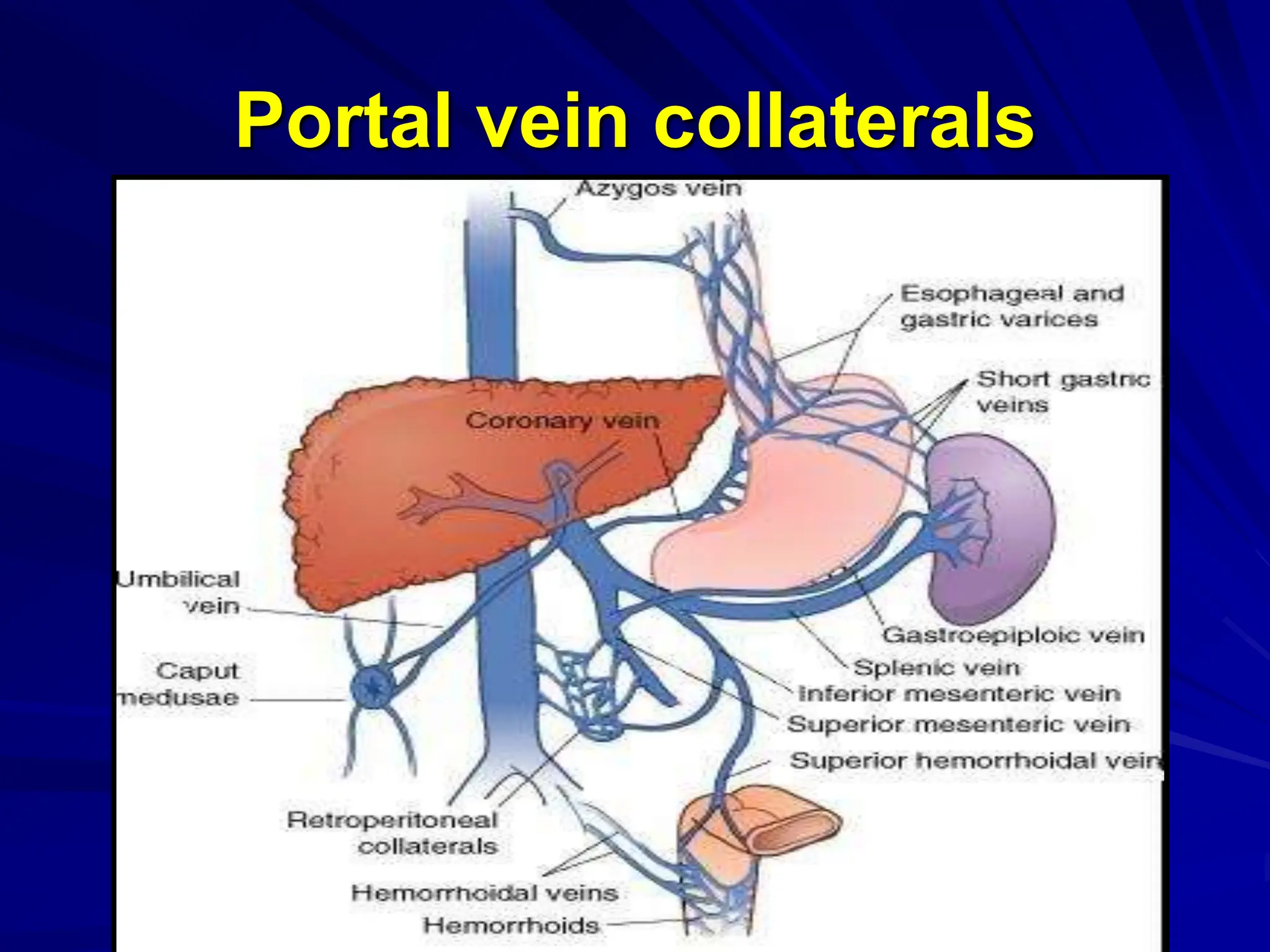 Portal vein collaterals
 