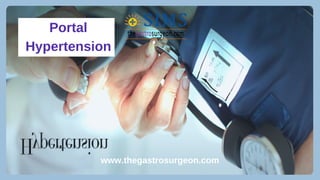 www.thegastrosurgeon.com
Portal
Hypertension
 