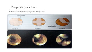 Approach to management of PORTAL HYPERTENSION , | PPTX