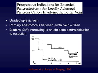 Ishikawa et al, Annals of Surgery, 1992
• Divided splenic vein
• Primary anastomosis between portal vein – SMV
• Bilateral SMV narrowing is an absolute contraindication
to resection
 