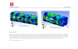 Spine Implants  During the actual testing of the spine implants it was noticed that new molded peek implants were failing under torsion and compression loads. Depuy Spine Inc has asked Baren-Boym Company to look into the problem. We have performed the FEA analysis on the existing implant and have found that in fact the design could not withstand the exerted loads. Baren-Boym Company has provided seventy-two designs and FEA tests to find three possible configurations that would be adequate to sustain necessary loading conditions. Client – Depuy Spine Inc, J&J ANALYTICAL 