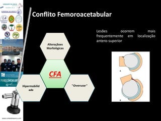 www.unidadedaanca.com 
Conflito Femoroacetabular 
Alteraçãoes 
Morfológicas 
CFA 
Hipermobilid “Overuse” 
ade 
Lesões ocorrem mais 
frequentemente em localização 
antero-superior 
 