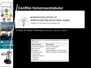 www.unidadedaanca.com 
Conflito Femoroacetabular 
A. Bedi; B.T. Kelly; V Khanduja. Bone Joint J. 2013; 95 – B 10-19 
 