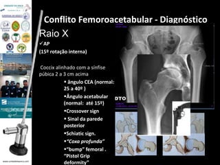 www.unidadedaanca.com 
Conflito Femoroacetabular - Diagnóstico 
Raio X 
AP 
(15º rotação interna) 
Coccix alinhado com a sínfise 
púbica 2 a 3 cm acima 
 ângulo CEA (normal: 
25 a 40º ) 
Ângulo acetabular 
(normal: até 15º) 
Crossover sign 
 Sinal da parede 
posterior 
Schiatic sign. 
“Coxa profunda” 
“bump” femoral . 
“Pistol Grip 
deformity” 
 
