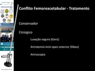 www.unidadedaanca.com 
Conflito Femoroacetabular - Tratamento 
Conservador 
Cirúrgico 
Luxação segura (Ganz) 
Artrotomia mini open anterior (Ribas) 
Artroscopia 
 