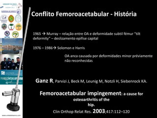 www.unidadedaanca.com 
Conflito Femoroacetabular - História 
1965  Murray – relação entre OA e deformidade subtil fémur “tilt 
deformity” – deslizamento epifise capital 
1976 – 1986 Solomon e Harris 
OA anca causada por deformidades minor préviamente 
não reconhecidas 
Ganz R, Parvizi J, Beck M, Leunig M, Notzli H, Siebenrock KA. 
Femoroacetabular impingement: a cause for 
osteoarthritis of the 
hip. 
Clin Orthop Relat Res. 2003;417:112–120 
 