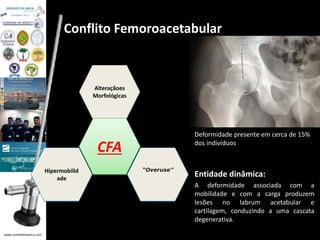 www.unidadedaanca.com 
Conflito Femoroacetabular 
Deformidade presente em cerca de 15% 
dos indivíduos 
Entidade dinâmica: 
A deformidade associada com a 
mobilidade e com a carga produzem 
lesões no labrum acetabular e 
cartilagem, conduzindo a uma cascata 
degenerativa. 
Alteraçãoes 
Morfológicas 
CFA 
Hipermobilid “Overuse” 
ade 
 