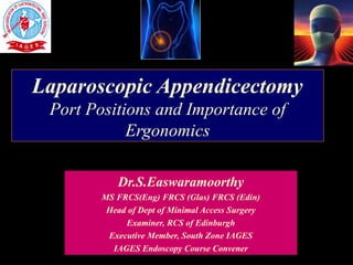 Laparoscopic Appendicectomy
Port Positions and Importance of
Ergonomics
Dr.S.Easwaramoorthy
MS FRCS(Eng) FRCS (Glas) FRCS (Edin)
Head of Dept of Minimal Access Surgery
Examiner, RCS of Edinburgh
Executive Member, South Zone IAGES
IAGES Endoscopy Course Convener
 