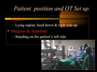 Patient position and OT Set up
• Patient
– Lying supine, head down & right side up
• Surgeon & Assistant
– Standing on the patient’s left side
 