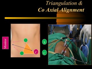 Triangulation &
Co Axial Alignment
C
S
C
 