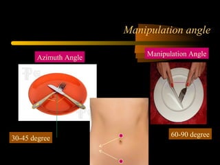 Manipulation angle
Azimuth Angle
Manipulation Angle
30-45 degree
60-90 degree
 