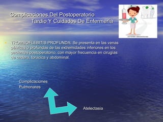 Complicaciones Del PostoperatorioComplicaciones Del Postoperatorio
Tardío Y Cuidados De EnfermeríaTardío Y Cuidados De Enfermería
• TROMBOFLEBITISTROMBOFLEBITIS PROFUNDA: Se presenta en las venasPROFUNDA: Se presenta en las venas
pélvicas o profundas de las extremidades inferiores en lospélvicas o profundas de las extremidades inferiores en los
pacientes postoperatorio, con mayor frecuencia en cirugíaspacientes postoperatorio, con mayor frecuencia en cirugías
de cadera, torácica y abdominal.de cadera, torácica y abdominal.
ComplicacionesComplicaciones
PulmonaresPulmonares
AtelectasiaAtelectasia
 