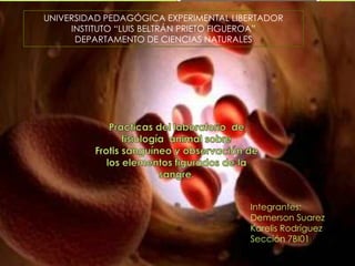 UNIVERSIDAD PEDAGÓGICA EXPERIMENTAL LIBERTADOR
INSTITUTO “LUIS BELTRÁN PRIETO FIGUEROA”
DEPARTAMENTO DE CIENCIAS NATURALES
Integrantes:
Demerson Suarez
Karelis Rodríguez
Sección 7BI011A
 