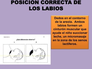 POSICION CORRECTA DE
LOS LABIOS
Dedos en el contorno
de la areola. Ambos
labios formen un
cinturón muscular que
ayude el niño succionar
leche, un micromasaje
en la zona de los senos
lactíferos.
 