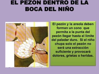 EL PEZON DENTRO DE LA
BOCA DEL NIÑO
El pezón y la areola deben
forman un cono que
permita a la punta del
pezón llegar hasta el límite
del paladar duro. Si el niño
chupa solo el pezón no
será una extracción
suficiente y provocará
dolores, grietas o heridas.
 