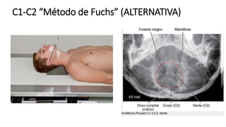 Fuchs Technique POSICIONAMENTO E ANATOMIA DA COLUNA VERTEBRAL.pdf