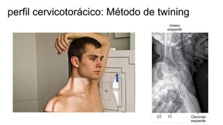 Twining Method Radiography POSICIONAMENTO COLUNA VERTEBRAL E ANATOMIA.pdf