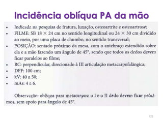 Incidência oblíqua PA da mão125