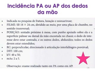 Incidência PA ou AP dos dedos da mão 138