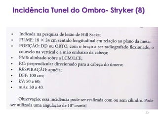 Incidência Tunel do Ombro- Stryker (8)33