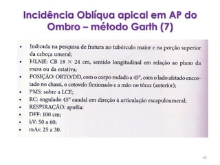 Incidência Oblíqua apical em AP do Ombro – método Garth (7)42