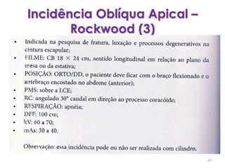 Incidência Oblíqua Apical – Rockwood (3)45