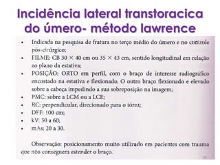 Incidência lateral transtoracica do úmero- método lawrence58