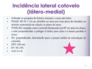 Incidência lateral cotovelo (látero-medial)65