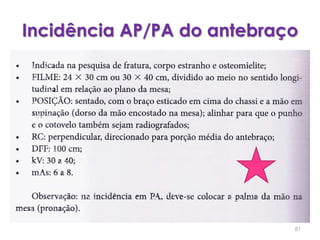 Incidência AP/PA do antebraço81