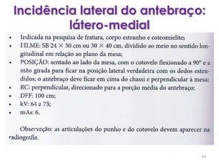 Incidência lateral do antebraço: látero-medial84