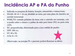 Incidência AP e PA do Punho88