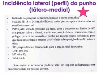 Incidência lateral (perfil) do punho (látero-medial)91